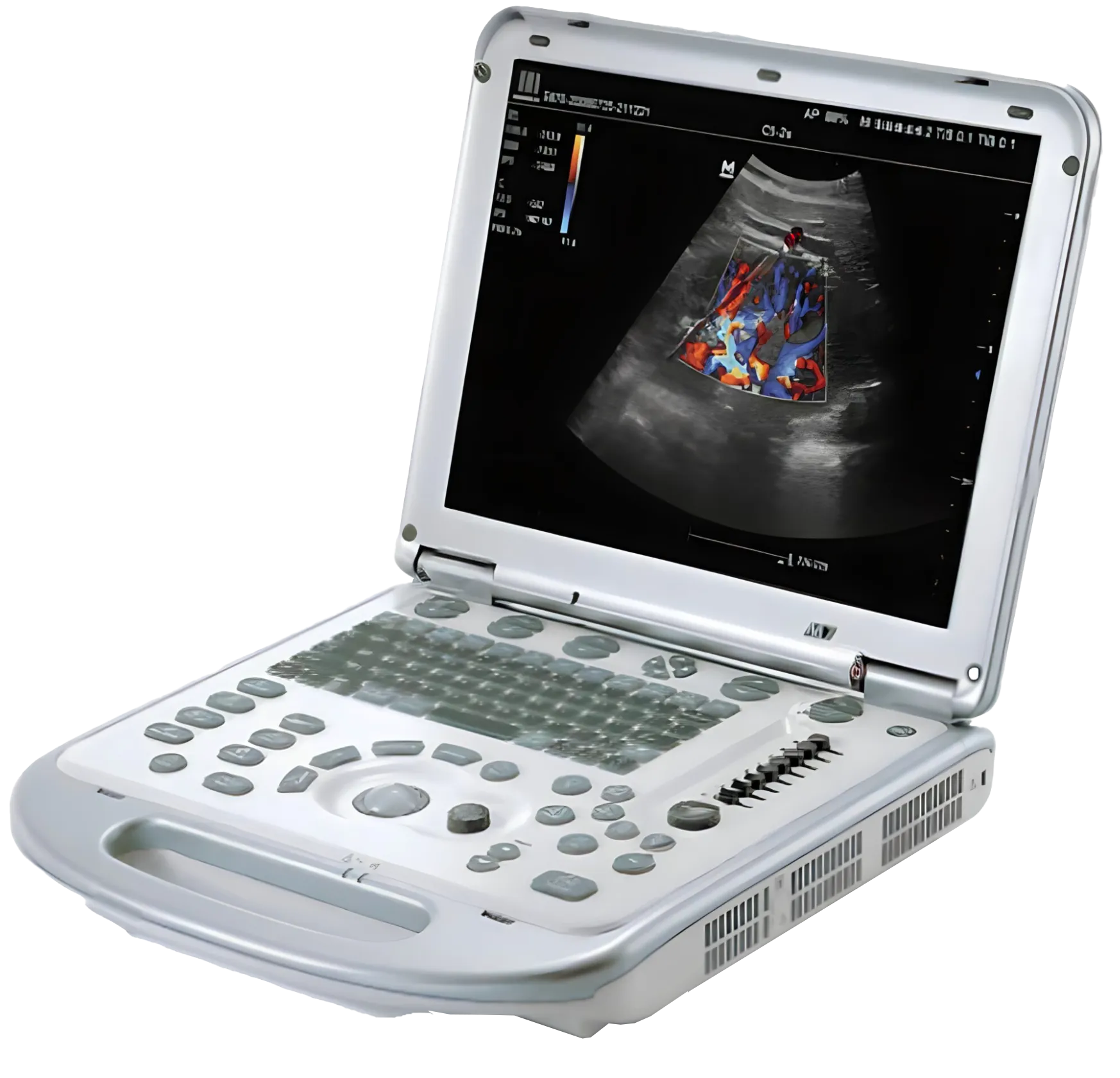 Mindray M7 Portable Ultrasound Machine